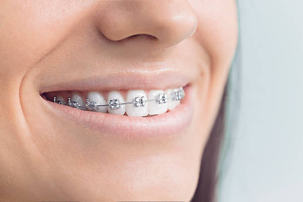 Best Dental Fillings (Composite and Amalgam)  in Paw Paw Lake, MI